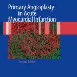 Primary Angioplasty in Acute Myocardial Infarction