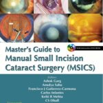 Master’s Guide to Manual Small Incision Cataract Surgery