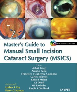Master’s Guide to Manual Small Incision Cataract Surgery