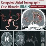 Computed Aided Tomography Case Histories BRAIN 2nd Edition