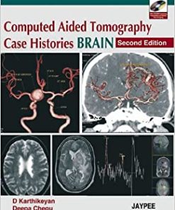 Computed Aided Tomography Case Histories BRAIN 2nd Edition
