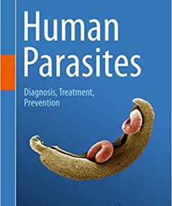 Human Parasites Diagnosis Treatment Prevention