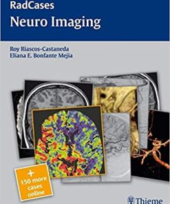 Radcases Neuro Imaging