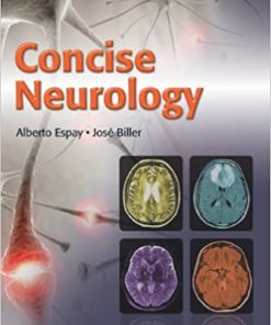 Concise Neurology