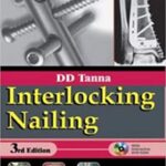 Interlocking Nailing 3rd Edition