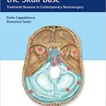 Meningiomas of the Skull Base Treatment Nuances in Contemporary Neurosurgery