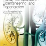 Kidney Transplantation Bioengineering and Regeneration Kidney Transplantation in the Regenerative Medicine Era