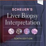 Scheuers Liver Biopsy Interpretation 10th Ed