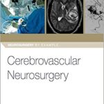 Cerebrovascular Neurosurgery
