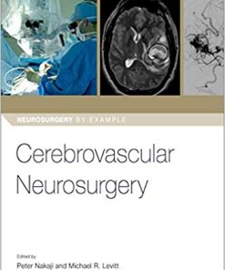 Cerebrovascular Neurosurgery