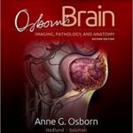 Osborns Brain imaging Pathology And Anatomy 2nd Ed
