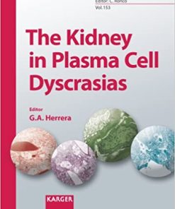The Kidney in Plasma Cell Dyscrasias