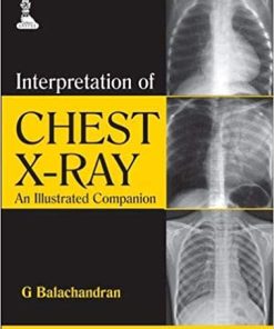 Interpretation of Chest X-Ray An Illustrated Companion