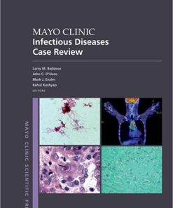Mayo Clinic Infectious Disease Case Review