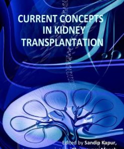 Current Concepts in Kidney Transplantation
