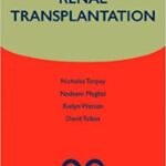 Renal Transplantation By Nicholas Torpey