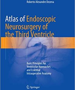 Atlas of Endoscopic Neurosurgery of the Third Ventricle Basic Principles for Ventricular Approaches and Essential Intraoperative Anatomy