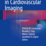 Dual Energy CT in Cardiovascular Imaging