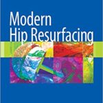 Modern Hip Resurfacing