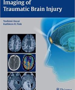 Imaging of Traumatic Brain Injury
