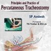Principles and Practice of Percutaneous Tracheostomy