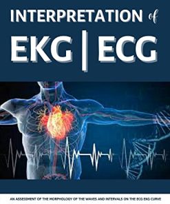 Interpretation Of EKG ECG