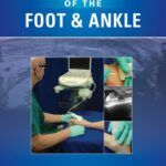 Ultrasound of The Foot and Ankle