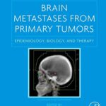 Brain Metastases from Primary Tumors Volume 2 Epidemiology Biology and Therapy