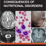 Neurological Consequences of Nutritional Disorders