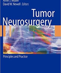 Tumor Neurosurgery Principles and Practice