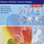 Acetabular Fractures Diagnosis Indications Treatment Strategies