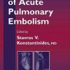 Management of Acute Pulmonary Embolism
