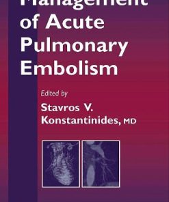 Management of Acute Pulmonary Embolism