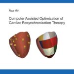 Computer Assisted Optimization of Cardiac Resynchronization Therapy