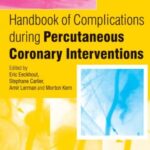 Handbook of Complications during Percutaneous Cardiovascular Interventions
