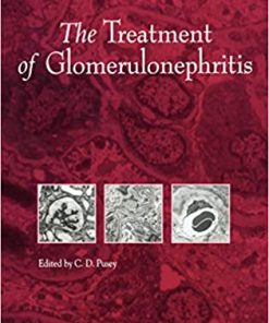 The Treatment of Glomerulonephritis