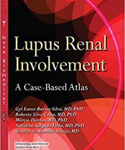 Lupus Renal Involvement A Case Based Atlas