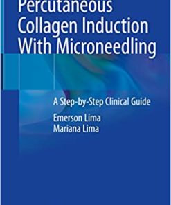 Percutaneous Collagen Induction With Microneedling A Step by Step Clinical Guide