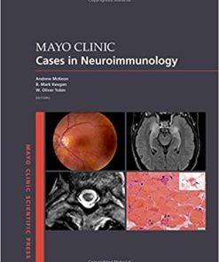 Mayo Clinic Cases in Neuroimmunology