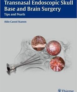 Transnasal Endoscopic Skull Base and Brain Surgery Tips and Pearls