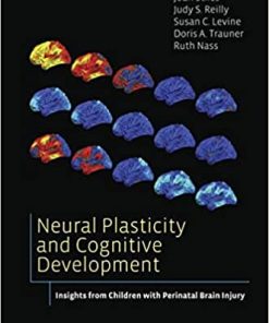 Neural Plasticity and Cognitive Development Insights from Children with Perinatal Brain Injury