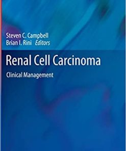 Renal Cell Carcinoma Clinical Management