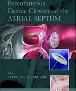 Percutaneous Device Closure of the Atrial Septum