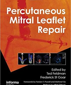 Percutaneous Mitral Leaflet Repair MitraClip Therapy for Mitral Regurgitation