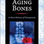 Aging Bones A Short History of Osteoporosis