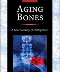 Aging Bones A Short History of Osteoporosis