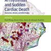 Ventricular Arrhythmias and Sudden Cardiac Death Mechanism Ablation and Defibrillation