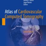 Atlas of Cardiovascular Computed Tomography 2nd Edition