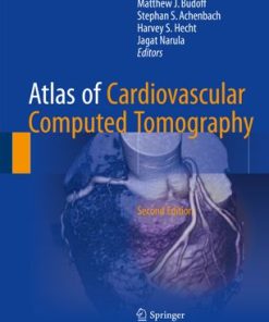 Atlas of Cardiovascular Computed Tomography 2nd Edition