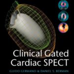 Clinical Gated Cardiac SPECT 2nd Ed